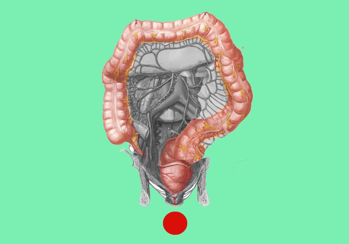 Chirurgia del Colon| intervento al colon| Dr.Marco Rovagnati